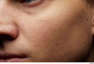 HD Face Skin Brett cheek face nose skin pores skin…